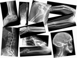 What are the dimensions of the X-rays?
